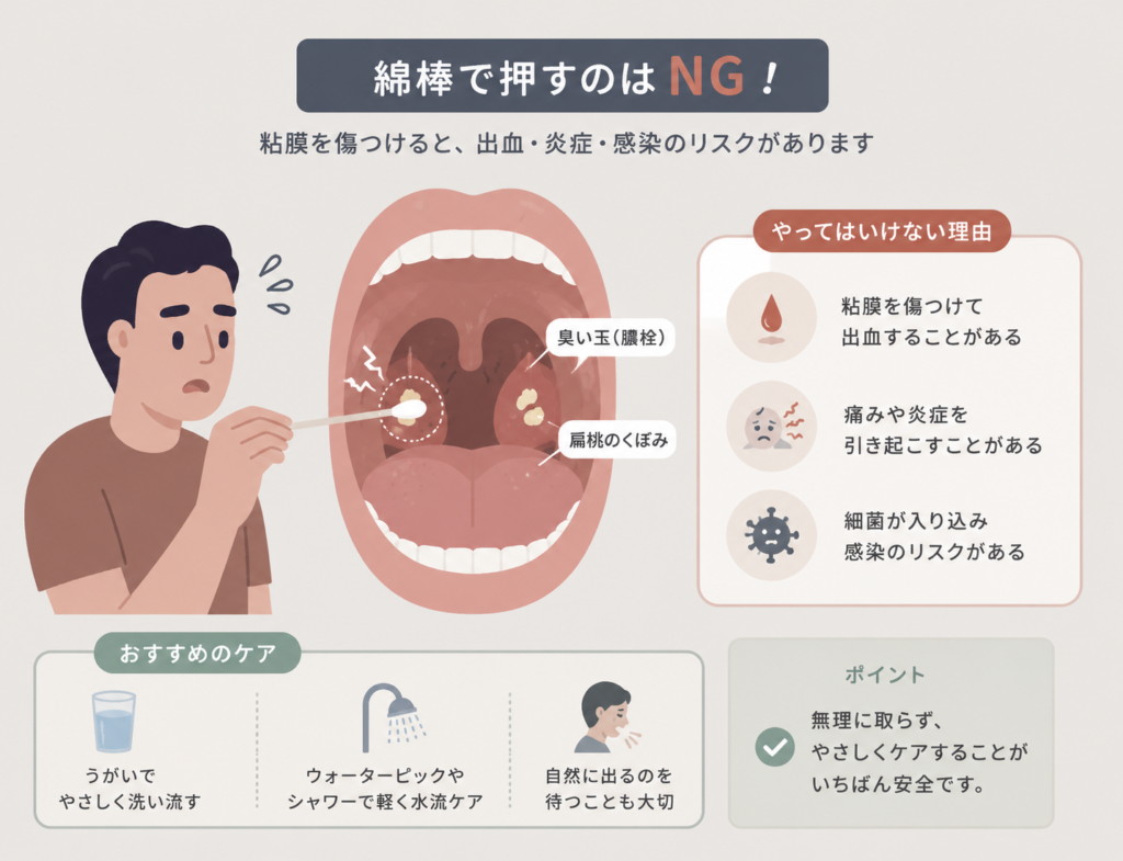 臭い玉を綿棒で押すのは危険｜自分で取る場合の注意点