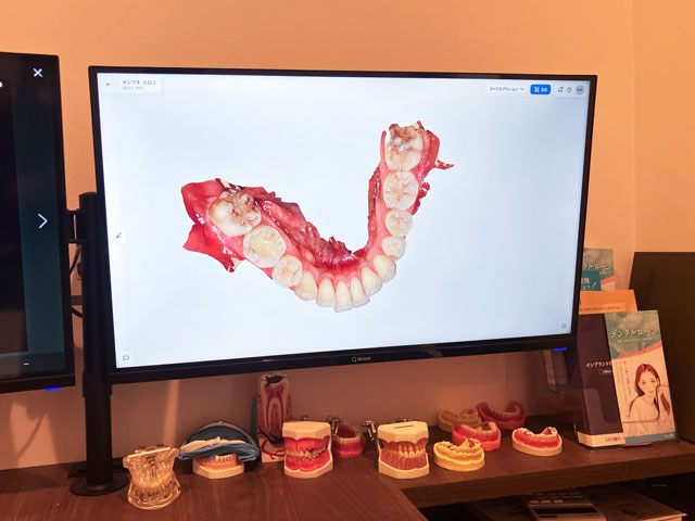 3D写真で見える化 大橋THREE歯科・矯正歯科