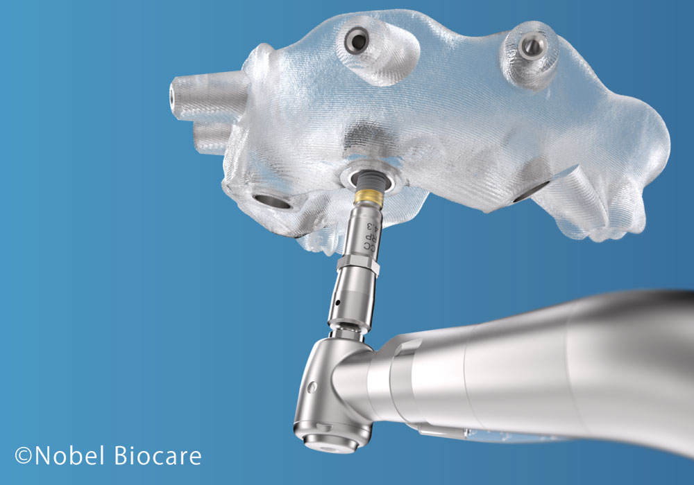 サージカルガイド　大橋THREE歯科・矯正歯科