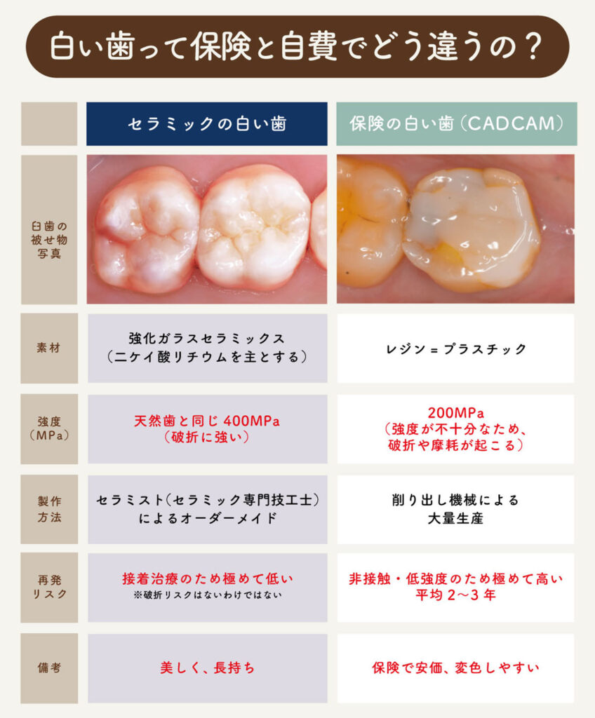 セラミックと保険診療の比較｜福岡市南区大橋の大橋THREE歯科・矯正歯科