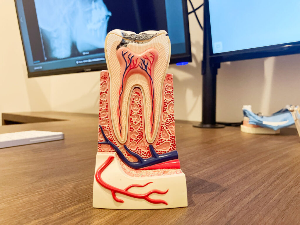 歯の断面図模型　大橋THREE歯科・矯正歯科