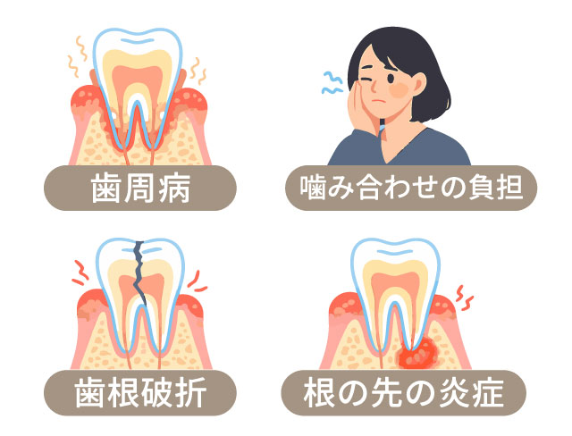 前歯がぐらつく主な原因の図解