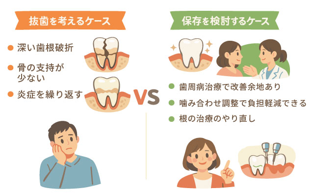 抜歯を検討するケースと保存を検討するケースの比較図
