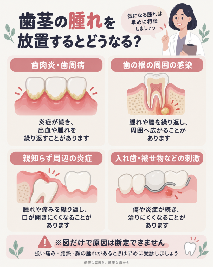 歯茎の腫れを放置した場合に起こり得るリスクを示す図解。歯周病の進行、歯の根の感染拡大、親知らず周囲の炎症、入れ歯や被せ物による刺激を解説